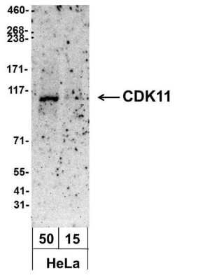 Western Blot: CDC2L2 Antibody [Biotin] [NBP1-71798] - Whole cell  lysate from HeLa (50 and 15 ug).  Antibody used at 1.0 ug/ml.